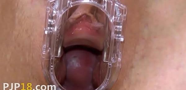  Gyno dildo and hard vagina opening